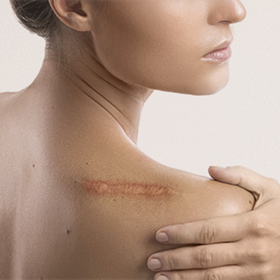 Imagem Cirurgias Reparadoras