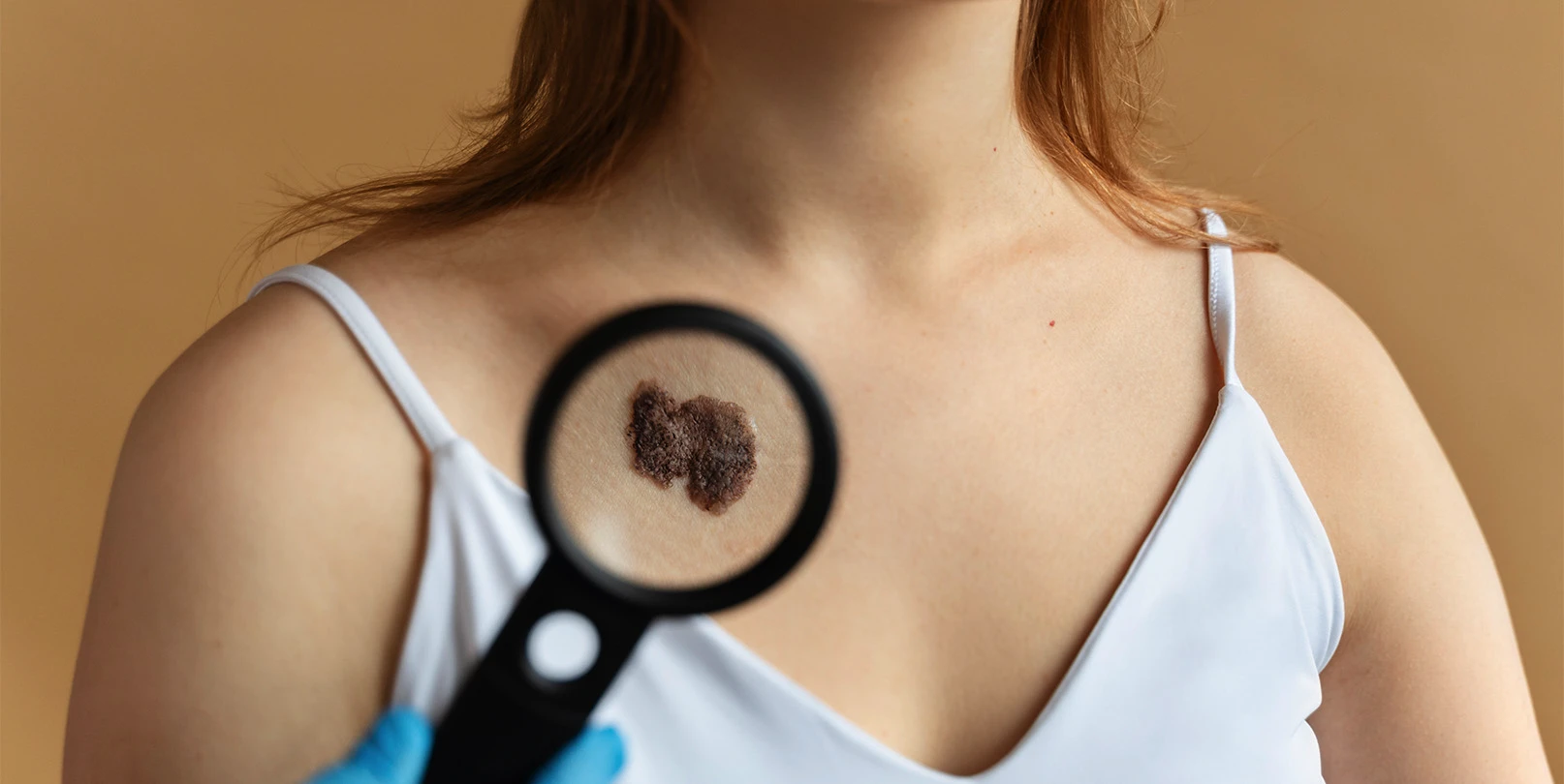 Imagem Reconstrução de Mama