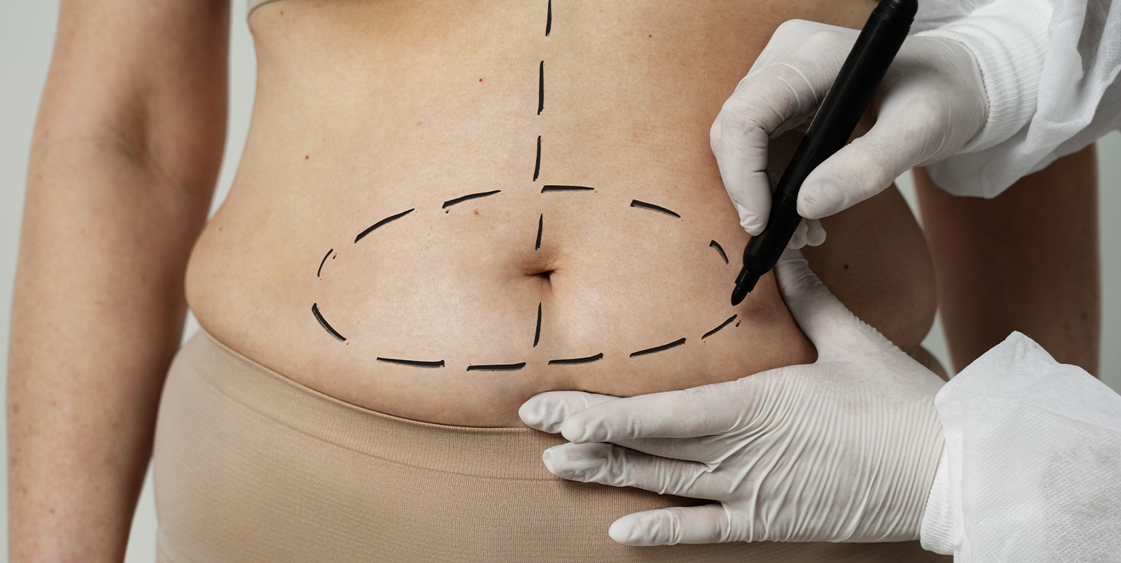 Imagem Reconstrução de Mama